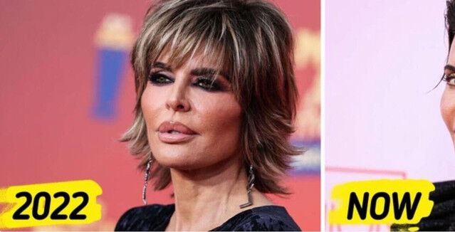Lisa Rinna: Embracing Style and Aging with Grace