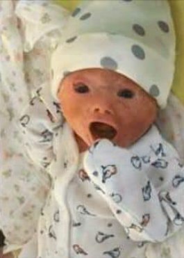 Doctors forced to do emergency caesarean section – dad sees baby’s face and room falls silent